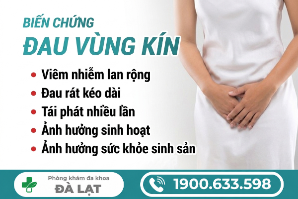 Hình ảnh minh họa